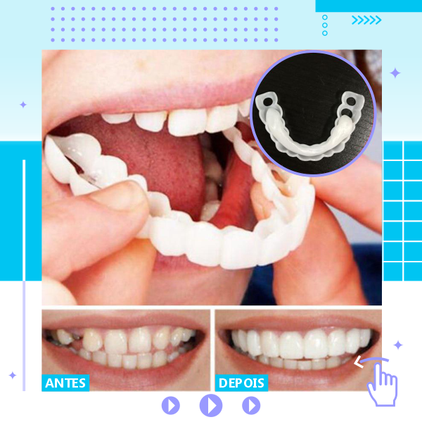 Snap On Smile – Lente Dental