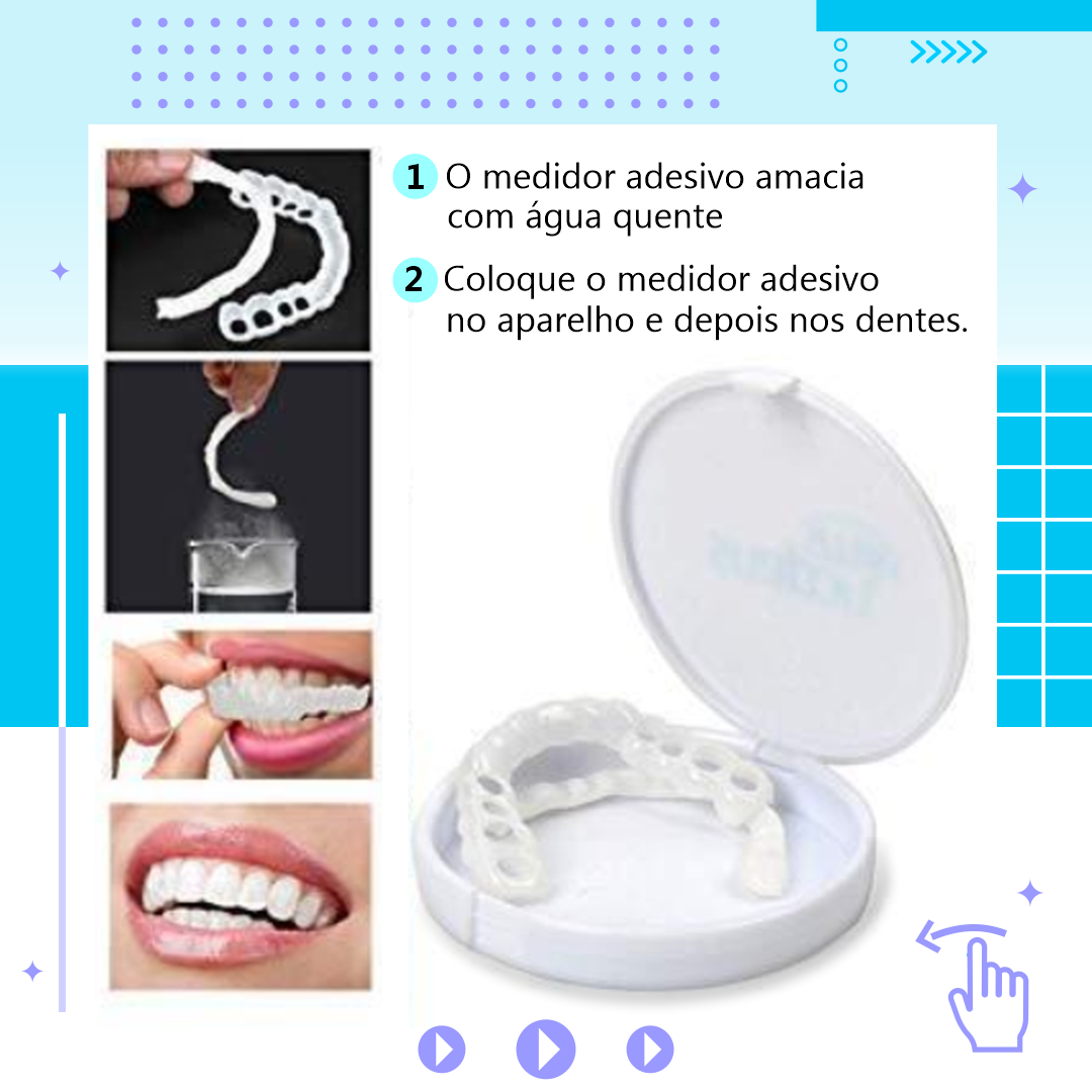 Snap On Smile – Lente Dental