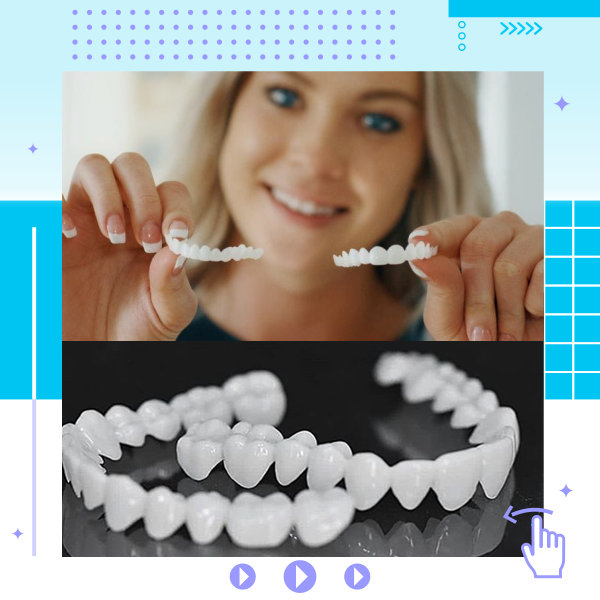 Snap On Smile – Lente Dental