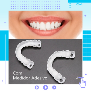 Snap On Smile – Lente Dental